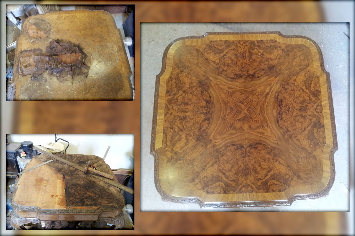 Veneer Restoration Work